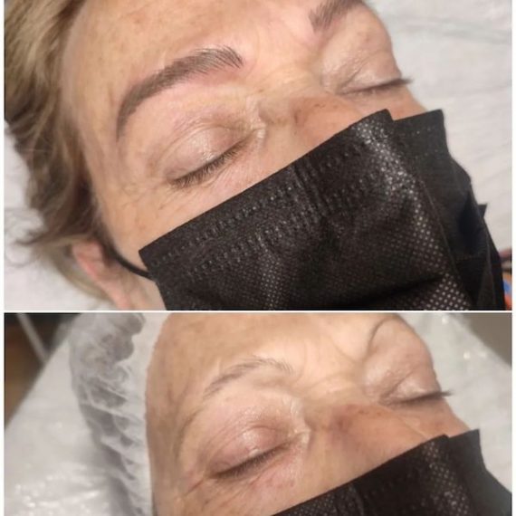 antes y despues de microblading 3