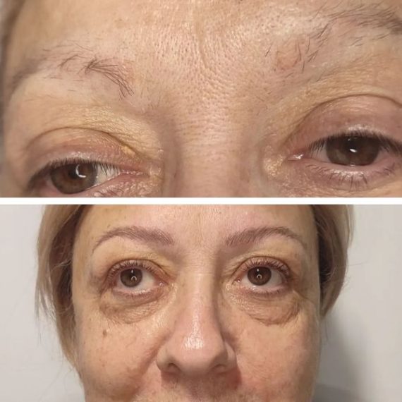antes y despues del microblading en barbarroja tattoo