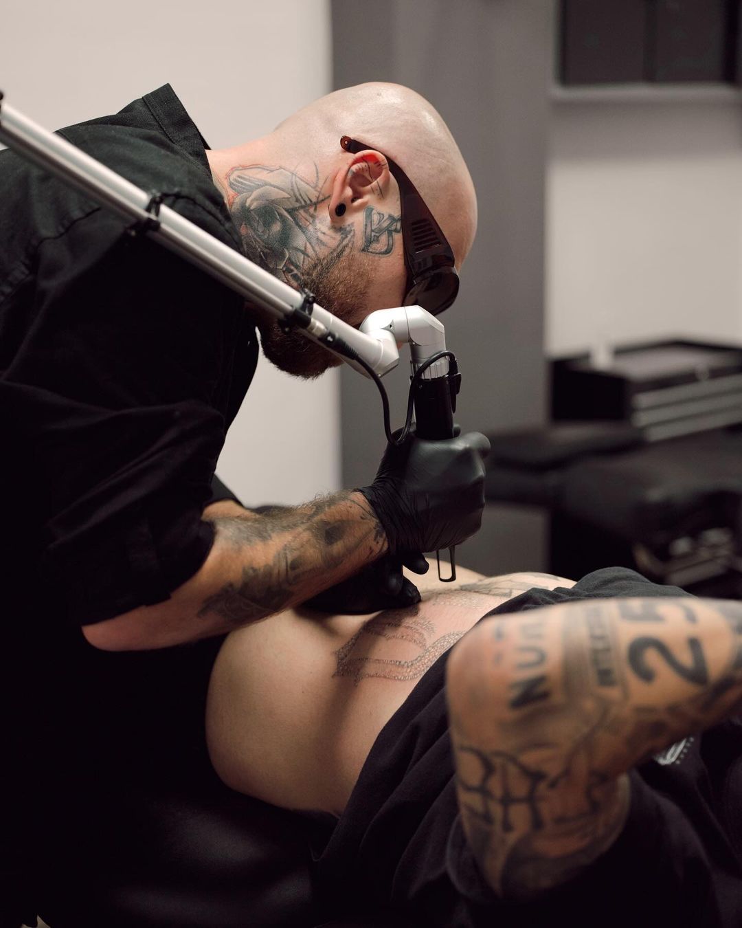 Eliminación tatuajes en Zaragoza Barbarroja Tattoo